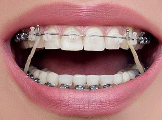Orthodontie Hoorn