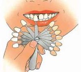 Kleur bepalen van de tanden bij een kroon of brug